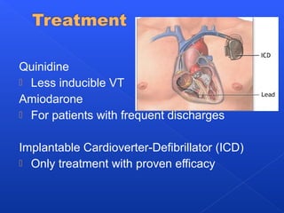 Quinidine
 Less inducible VT
Amiodarone
 For patients with frequent discharges
Implantable Cardioverter-Defibrillator (ICD)
 Only treatment with proven efficacy
 