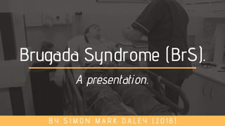 Brugada Syndrome (BrS).
B Y S I M O N M A R K D A L E Y ( 2 0 1 8 )
A presentation.
 