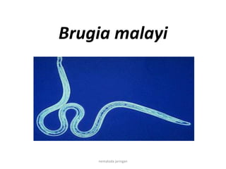 Brugia malayi

nematoda jaringan

 
