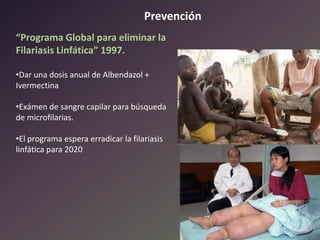 Prevención
“Programa Global para eliminar la
Filariasis Linfática” 1997.
•Dar una dosis anual de Albendazol +
Ivermectina
•Exámen de sangre capilar para búsqueda
de microfilarias.
•El programa espera erradicar la filariasis
linfática para 2020

 