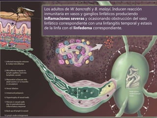 Los adultos de W. bancrofti y B. malayi. Inducen reacción
inmunitaria en vasos y ganglios linfáticos produciendo
inflamaciones severas y ocasionando obstrucción del vaso
linfático correspondiente con una linfangitis temporal y estasis
de la linfa con el linfedema correspondiente.

 
