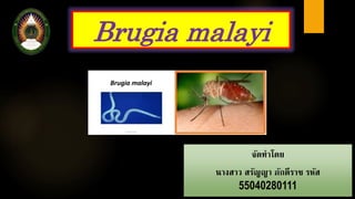 Brugia malayi
จัดทำโดย
นำงสำว สรัญญำ ภักดีรำช รหัส
55040280111
 
