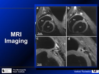 The Minneapolis Heart
Institute Foundation
The Minneapolis
Heart Institute
MRI
Imaging
 