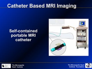 The Minneapolis Heart
Institute Foundation
The Minneapolis
Heart Institute
Self-contained
portable MRI
catheter
Catheter Based MRI Imaging
 