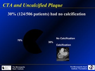 The Minneapolis Heart
Institute Foundation
The Minneapolis
Heart Institute
30% (124/506 patients) had no calcification
CTA and Uncalcified Plaque
30%
70%
No Calcification
Calcification
 