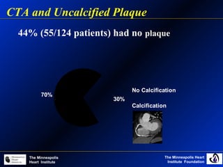 The Minneapolis Heart
Institute Foundation
The Minneapolis
Heart Institute
44% (55/124 patients) had no plaque
CTA and Uncalcified Plaque
30%
70%
No Calcification
Calcification
 