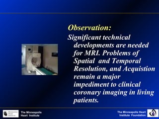 The Minneapolis Heart
Institute Foundation
The Minneapolis
Heart Institute
Observation:
Significant technical
developments are needed
for MRI. Problems of
Spatial and Temporal
Resolution, and Acquistion
remain a major
impediment to clinical
coronary imaging in living
patients.
 