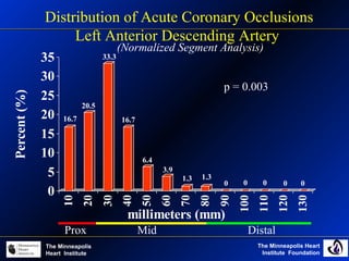 The Minneapolis Heart
Institute Foundation
The Minneapolis
Heart Institute
16.7
20.5
33.3
16.7
6.4
3.9
1.3 1.3
0 0 0 0 0
0
5
10
15
20
25
30
35
Percent(%)
10
20
30
40
50
60
70
80
90
100
110
120
130
millimeters (mm)
Prox Mid Distal
p = 0.003
Distribution of Acute Coronary Occlusions
Left Anterior Descending Artery
(Normalized Segment Analysis)
 