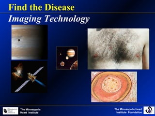 The Minneapolis Heart
Institute Foundation
The Minneapolis
Heart Institute
Find the Disease
Imaging Technology
 