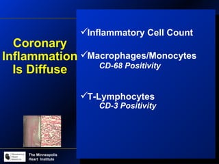 The Minneapolis Heart
Institute Foundation
The Minneapolis
Heart Institute
Inflammatory Cell Count
Macrophages/Monocytes
CD-68 Positivity
T-Lymphocytes
CD-3 Positivity
Coronary
Inflammation
Is Diffuse
 