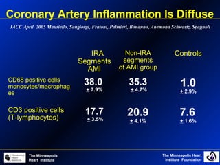 The Minneapolis Heart
Institute Foundation
The Minneapolis
Heart Institute
IRA
Segments
AMI
Non-IRA
segments
of AMI group
Controls
CD68 positive cells
monocytes/macrophag
es
38.0
+ 7.9%
35.3
+ 4.7%
1.0
+ 2.9%
CD3 positive cells
(T-lymphocytes)
17.7
+ 3.5%
20.9
+ 4.1%
7.6
+ 1.6%
Coronary Artery Inflammation Is Diffuse
JACC April 2005 Mauriello, Sangiorgi, Fratoni, Palmieri, Bonanno, Anemona Schwartz, Spagnoli
 