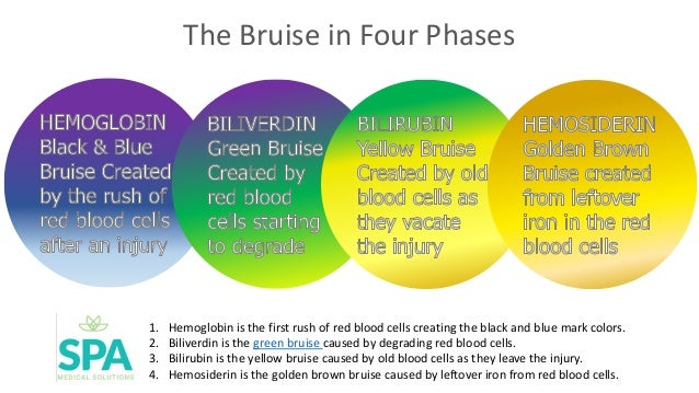 Bruise Color Chart