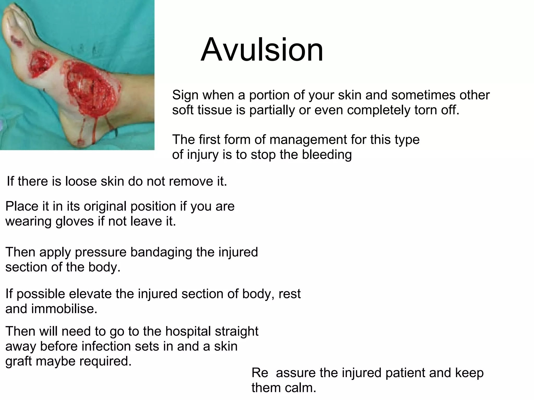 Avulsion  Sign when a portion of your skin and sometimes other soft tissue is partially or even completely torn off.  The first form of management for this type of injury is to stop the bleeding Then apply pressure bandaging the injured section of the body.  Then will need to go to the hospital straight away before infection sets in and a skin graft maybe required.  If there is loose skin do not remove it.  Place it in its original position if you are wearing gloves if not leave it. If possible elevate the injured section of body, rest and immobilise.  Re  assure the injured patient and keep them calm.  