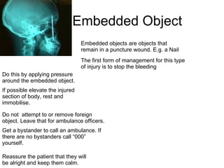 Embedded Object  Embedded objects are objects that remain in a puncture wound. E.g. a Nail  The first form of management for this type of injury is to stop the bleeding Do this by applying pressure around the embedded object. Do not  attempt to or remove foreign object. Leave that for ambulance officers. Get a bystander to call an ambulance. If there are no bystanders call “000” yourself.  Reassure the patient that they will be alright and keep them calm. If possible elevate the injured section of body, rest and immobilise.  
