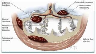 BRUK PLACENTA development AND Amniotic fluid metabolism.ppt