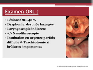 Examen ORL :
•
•
•
•
•

Lésions ORL 40 %
Dysphonie, dyspnée laryngée.
Laryngoscopie indirecte
+/- Nasofibroscopie
Intubation en urgence parfois
difficile  Trachéotomie si
brûlures importantes

E. Sarfati, Service de Chirurgie Générale, Hôpital Saint-Louis,2002

 