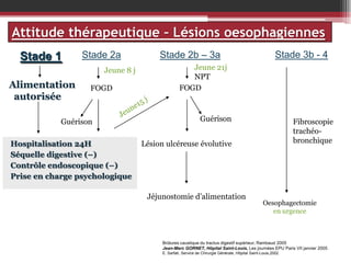 Attitude thérapeutique – Lésions oesophagiennes
Stade 1

Stade 2a
Jeune 8 j

Alimentation
autorisée

FOGD

Guérison
Guérison = 0
Hospitalisation 24H
Séquelle digestive (–)
Contrôle endoscopique (–)
Prise en charge psychologique

Stade 2b – 3a

Stade 3b - 4

Jeune 21j
NPT
FOGD

Guérison

Fibroscopie
trachéobronchique

Lésion ulcéreuse évolutive

Jéjunostomie d’alimentation

Oesophagectomie
en urgence

Brûlures caustique du tractus digestif supérieur, Rambaud 2005
Jean-Marc GORNET, Hôpital Saint-Louis, Les journées EPU Paris VII janvier 2005
E. Sarfati, Service de Chirurgie Générale, Hôpital Saint-Louis,2002

 