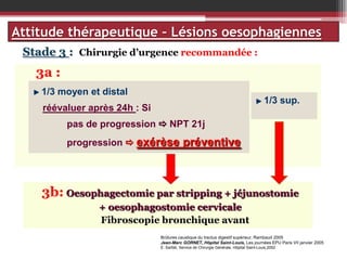 Attitude thérapeutique – Lésions oesophagiennes
Stade 3 : Chirurgie d’urgence recommandée :

3a :
1/3 moyen et distal

1/3 sup.

réévaluer après 24h : Si
pas de progression  NPT 21j
progression  exérèse préventive

3b: Oesophagectomie par stripping + jéjunostomie
+ oesophagostomie cervicale
Fibroscopie bronchique avant
Brûlures caustique du tractus digestif supérieur, Rambaud 2005
Jean-Marc GORNET, Hôpital Saint-Louis, Les journées EPU Paris VII janvier 2005
E. Sarfati, Service de Chirurgie Générale, Hôpital Saint-Louis,2002

 