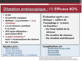 Dilatation endoscopique : (1) Efficace 8O%
 S/AG
 S/contrôle scopique
 Rythme : 2-3/semaine  /2-3
semaines
 2 à 20 séances, pendant
6-12 mois
 IPP après dilatation :
prévention RGO
 4-5ème semaines ?
tard  cicatrisations des lésions
tôt  fraîche
Récidive 20% :
• fibrose définitive,
• sténose trop étendue
• œsophagite peptique
Échec  après un nombre +++ de séances.

Évaluation après 1 an :
clinique + calibre de
l’œsophage (> 9 mm);
en fonction :
- De l'état initial de la
sténose
- Du nombre de séances
- Du résultat nutritionnel

Complications 3%:
▫
▫
▫
▫

Perforation (0,25-0,9%)
Hémorragie
Bactériémie
Cancérisation

B.Touchee, N.oumnia, M. Lahcebne,A.Toubaibia,A.Djenaoui,Hopital Kouba,avril 2004
REUNION DE CONSENSUS SUR LES LESIONS CAUSTIQUES DU TUBE DIGESTIF, mai 1999
SOCIETE ALGERIENNE D'ANESTHESIE-REANIMATION DE SOINS INTENSIFS ET D'URGENCE

 