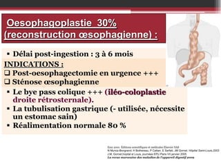Oesophagoplastie 30%
(reconstruction œsophagienne) :
 Délai post-ingestion : 3 à 6 mois
 Bilan psychiatrique
INDICATIONS :
 Post-oesophagectomie en urgence +++
 Examen ORL
 Sténose œsophagienne > 60 ans
 Coloscopie totale si âge
 Le bye pass colique +++ (iléo-coloplastie
droite rétrosternale).
 La tubulisation gastrique (- utilisée, nécessite
un estomac sain)
 Réalimentation normale 80 %
Emc 2001 Éditions scientifiques et médicales Elsevier SAS
N Munoz-Bongrand, H Bothereau, P Cattan, E Sarfati, JM Gornet. Hôpital Saint-Louis,2003
J,M, Gornet,hopital st Louis, journées EPU Paris VII janvier 2005
La revue marocaine des maladies de l’appareil digestif 2009

 