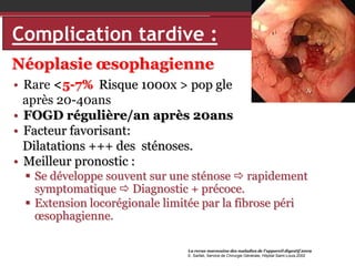Complication tardive :
Néoplasie œsophagienne
• Rare <5-7% Risque 1000x > pop gle
après 20-40ans
• FOGD régulière/an après 20ans
• Facteur favorisant:
Dilatations +++ des sténoses.
• Meilleur pronostic :
 Se développe souvent sur une sténose  rapidement
symptomatique  Diagnostic + précoce.
 Extension locorégionale limitée par la fibrose péri
œsophagienne.
La revue marocaine des maladies de l’appareil digestif 2009
E. Sarfati, Service de Chirurgie Générale, Hôpital Saint-Louis,2002

 