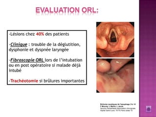 -Lésions chez 40% des patients

-Clinique : trouble de la déglutition,
dysphonie et dyspnée laryngée

-Fibroscopie ORL lors de l’intubation
ou en post opératoire si malade déjà
intubé

-Trachéotomie si brûlures importantes




                                         Brûlures caustiques de l'œsophage Sfar 96
                                         F Mourey, L Martin, L Jacob
                                         Service d'anesthésie-réanimation chirurgicale,
                                         hôpital Saint-Louis, 75175 Paris cedex 10
 