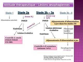 Attitude thérapeutique – Lésions œsophagiennes

      Stade 1            Stade 2a            Stade 2b Ŕ 3a                                 Stade 3b - 4
                                Jeune 8 j             Jeune 21j
                                                      NPT
Alimentation autorisée       FOGD                  FOGD    Jéjunostomie d’alimentation
                                                                              à j10 dans les stades III

                Guérison                                 Lésion ulcéreuse                            Fibroscopie
                                                             évolutive                               trachéo-
                         Lésion évolutive        Guérison                                            bronchique

      Contrôle à 1mois
      FOGD/TOGD                                           Jéjunostomie d’alimentation à j21
      EX ORL

                                            Contrôle 6-8 semaines
                                              (sténose 70%)                                   Oesophagectomie
                                                                                                 en urgence


                                                    Brûlures caustique du tractus digestif supérieur, Rambaud 2005
                                                    Jean-Marc GORNET, Hôpital Saint-Louis,
                                                    Les journées EPU Paris VII janvier 2005
                                                    E. Sarfati, Service de Chirurgie Générale, Hôpital Saint-Louis,2002
 