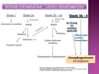 Attitude thérapeutique – Lésions oesophagiennes

     Stade 1             Stade 2a                     Stade 2b – 3a                                    Stade 3b - 4
                               Jeune 8 j                            Jeune 21j
                                                                    NPT
                                                                                                 3a 1/3 sup.
Alimentation immédiate     FOGD                                  FOGD                                ou
                                                                                                  évolutive
                                                                                                 après 24h
                 Guérison                                                    Guérison
                                                                                                                 Fibroscopie
                                                                                                                 trachéo-
                         Guérison = 0                Lésion ulcéreuse                                            bronchique
                                                         évolutive
     Control à 1mois




                                        Jéjunostomie d’alimentation
                                                                                                     Oesophagectomie
                                                                                                        en urgence

                                           Brûlures caustique du tractus digestif supérieur, Rambaud 2005
                                           Jean-Marc GORNET, Hôpital Saint-Louis, Les journées EPU Paris VII janvier 2005
                                           E. Sarfati, Service de Chirurgie Générale, Hôpital Saint-Louis,2002
 