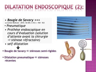 • Bougie de Savary +++
  La tunisie Medicale - 2010 ; Vol 88 ( n 012 ) : 920 – 923

 • Pneumatique
 • Prothèse endoscopique en
   cours d’évaluation (solution
   d’attente avant la chirurgie
    sténose réfractaire)
 • self dilatation
 •                
 Bougie de Savary  sténoses semi-rigides

 Dilatation pneumatique  sténoses
  récentes
 