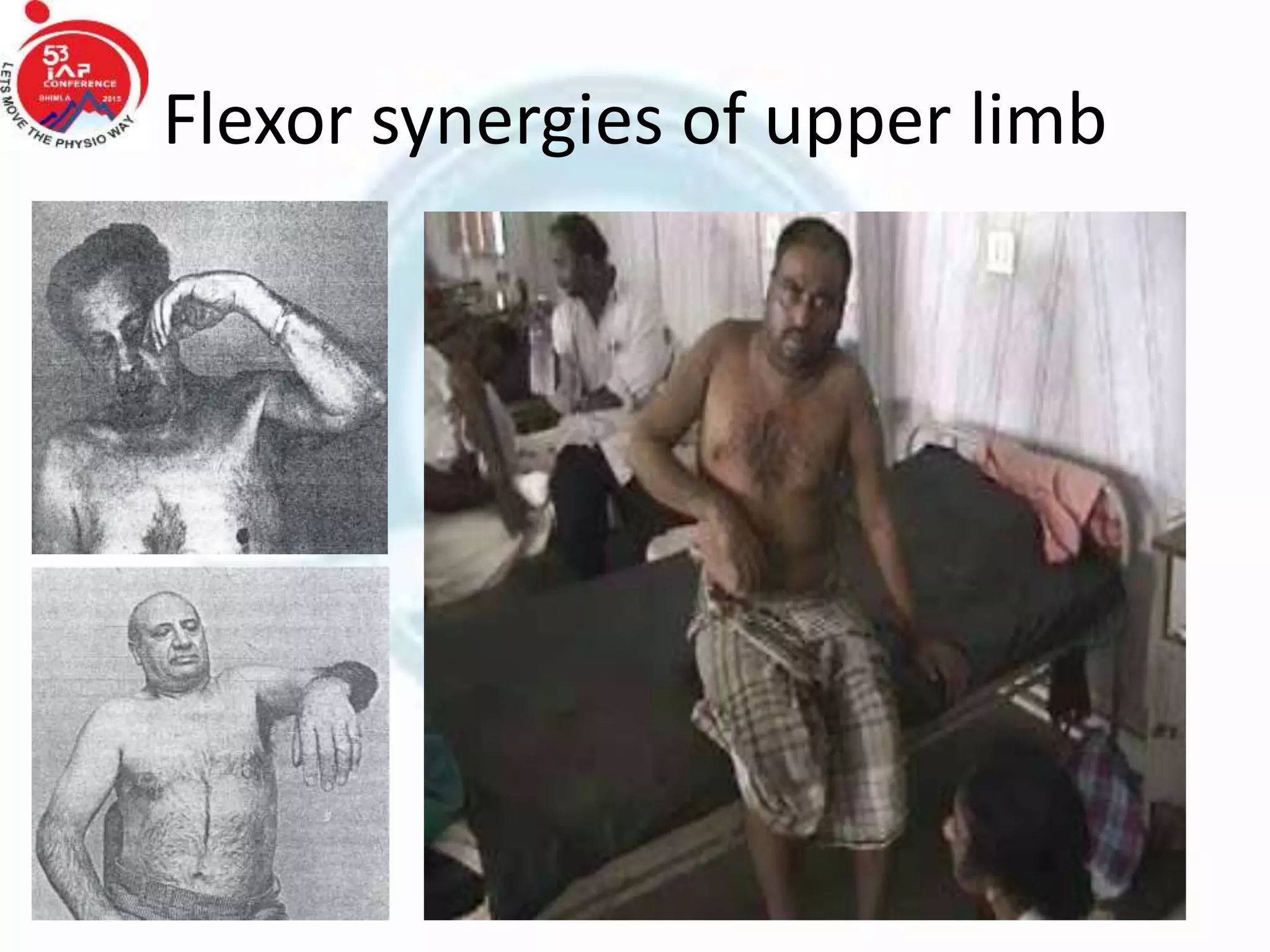 Flexor synergies of upper limb
 
