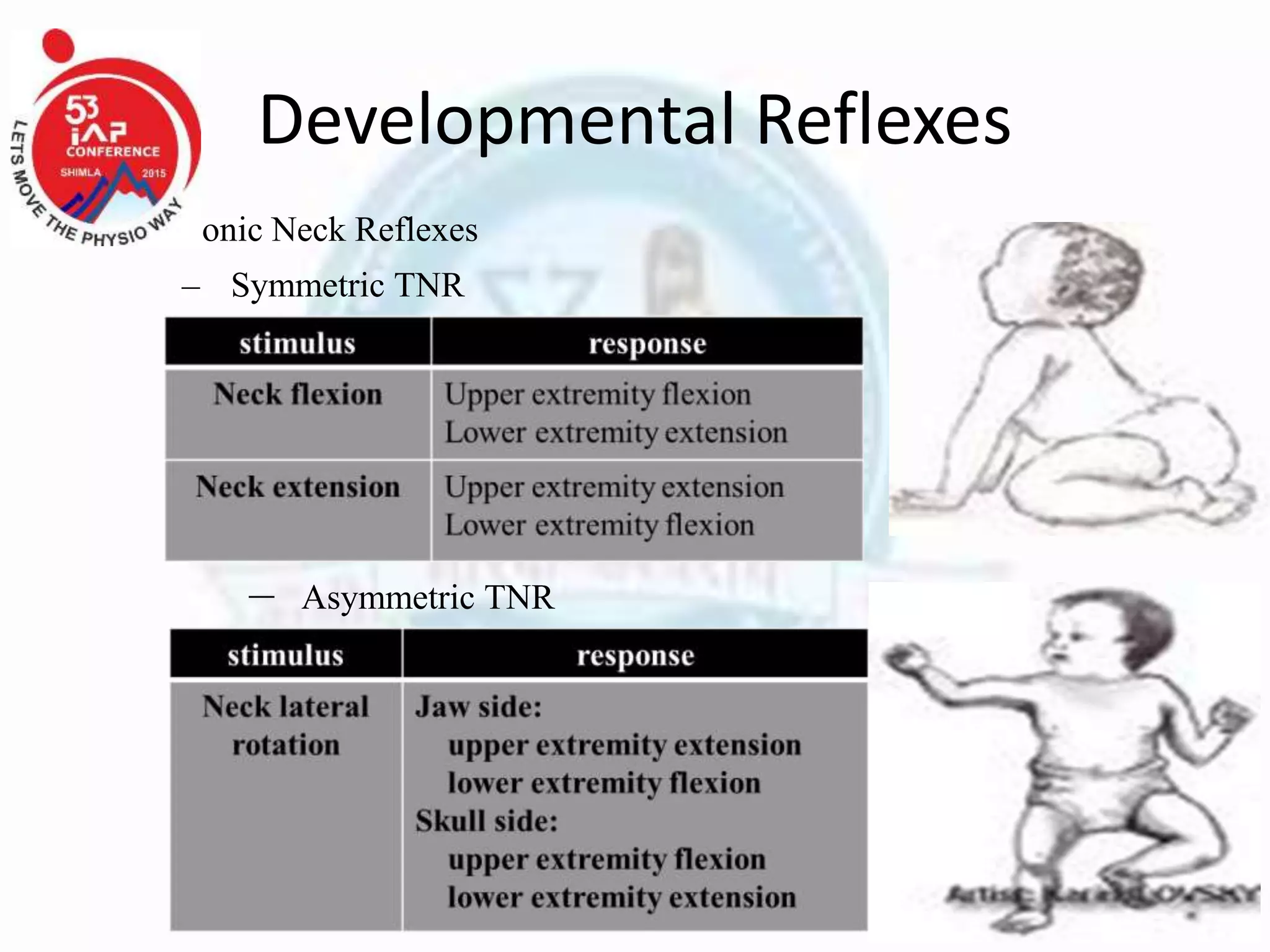 Developmental Reflexes
• Tonic Neck Reflexes
– Symmetric TNR
– Asymmetric TNR
 