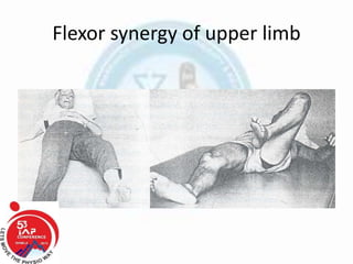 Flexor synergy of upper limb
 
