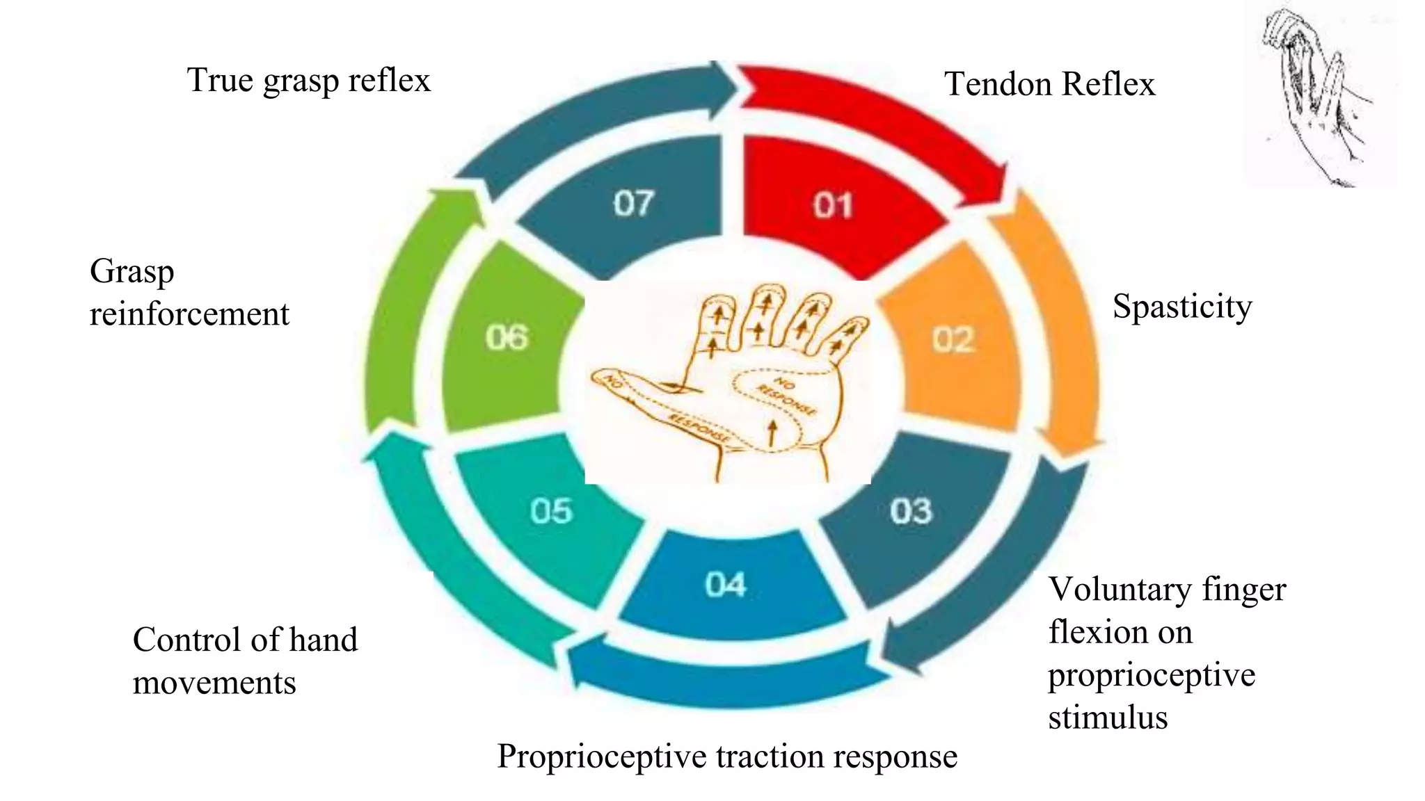 Tendon Reflex
Spasticity
Voluntary finger
flexion on
proprioceptive
stimulus
Proprioceptive traction response
Control of hand
movements
Grasp
reinforcement
True grasp reflex
 