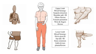 Upper Limb
Mixed Synergy:
Scapula retraction
Shoulder add.+IR
Elbow flexion
Forearm pronation
Wrist & fingers
flexion
Lower Limb
Mixed Synergy:
Pelvis post tilt
hip add.+IR
Knee extension
Ankle & toes
plantarflexion
 