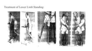 Treatment of Lower Limb Standing:
 