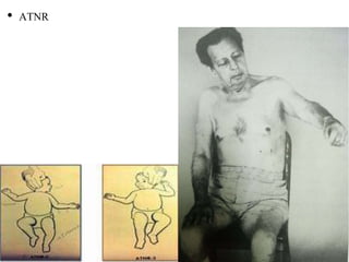 • ATNR
 
