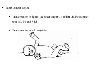 • Tonic Lumbar Reflex
• Trunk rotation to right :- Inc flexor tone rt UE and lft LE, inc extensor
tone in L UE and R LE
• Trunk rotation to left - opposite.
 