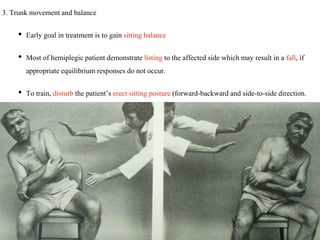 3. Trunk movement and balance
• Early goal in treatment is to gain sitting balance
• Most of hemiplegic patient demonstrate listing to the affected side which may result in a fall, if
appropriate equilibrium responses do not occur.
• To train, disturb the patient’s erect sitting posture (forward-backward and side-to-side direction.
 
