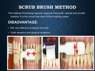 SCRUB BRUSH METHOD
This method of brushing requires vigorous horizontal, vertical and circular
motions. It is the virtual ...