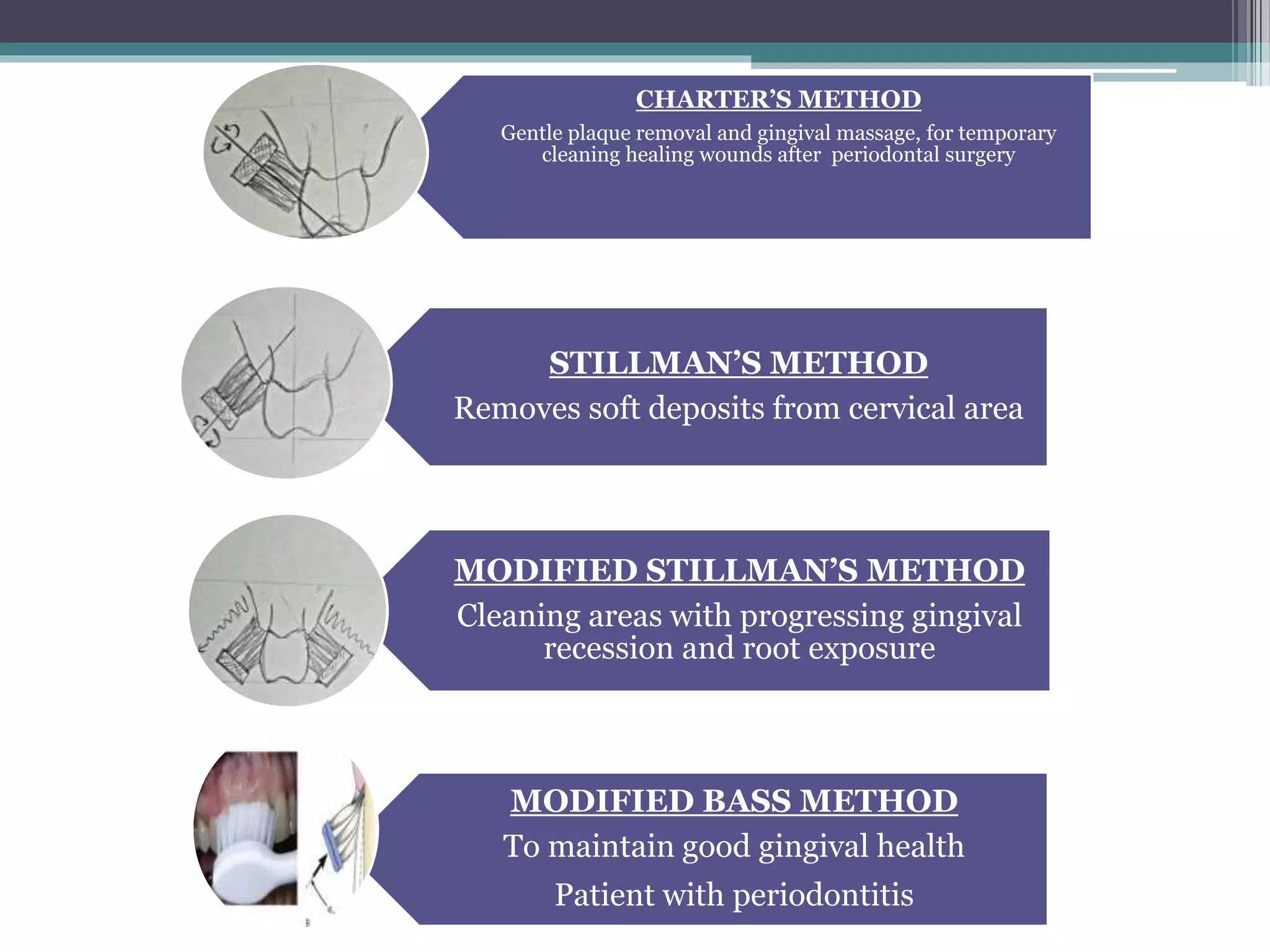 STILLMAN’S METHOD
Removes soft deposits from cervical area
CHARTER’S METHOD
Gentle plaque removal and gingival massage, for temporary
cleaning healing wounds after periodontal surgery
MODIFIED STILLMAN’S METHOD
Cleaning areas with progressing gingival
recession and root exposure
MODIFIED BASS METHOD
To maintain good gingival health
Patient with periodontitis
 
