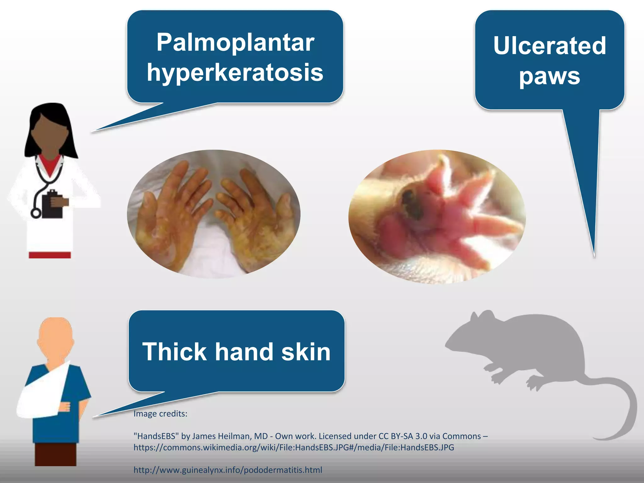 Ulcerated
paws
Palmoplantar
hyperkeratosis
Thick hand skin
Image credits:
"HandsEBS" by James Heilman, MD - Own work. Licensed under CC BY-SA 3.0 via Commons –
https://commons.wikimedia.org/wiki/File:HandsEBS.JPG#/media/File:HandsEBS.JPG
http://www.guinealynx.info/pododermatitis.html
 