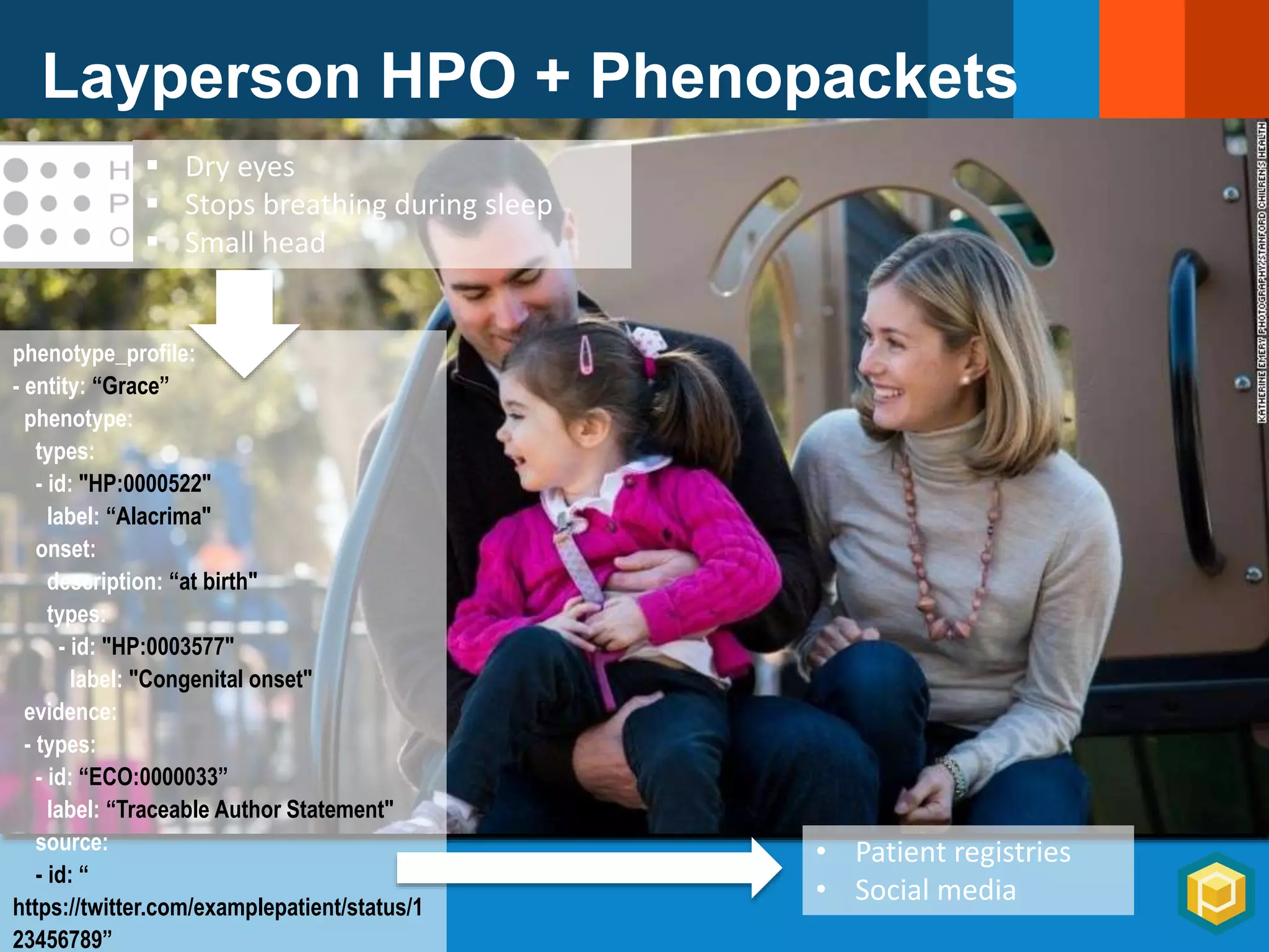 Layperson HPO + Phenopackets
 Dry eyes
 Stops breathing during sleep
 Small head
phenotype_profile:
- entity: “Grace”
phenotype:
types:
- id: "HP:0000522"
label: “Alacrima"
onset:
description: “at birth"
types:
- id: "HP:0003577"
label: "Congenital onset"
evidence:
- types:
- id: “ECO:0000033”
label: “Traceable Author Statement"
source:
- id: “
https://twitter.com/examplepatient/status/1
23456789”
• Patient registries
• Social media
 