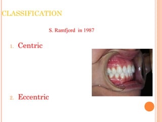 CLASSIFICATION
1. Centric
2. Eccentric
S. Ramfjord in 1987
 