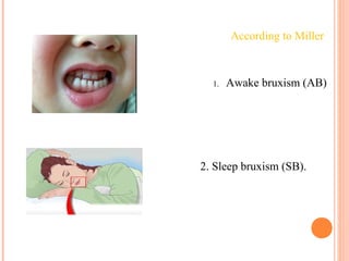 1. Awake bruxism (AB)
2. Sleep bruxism (SB).
According to Miller
 