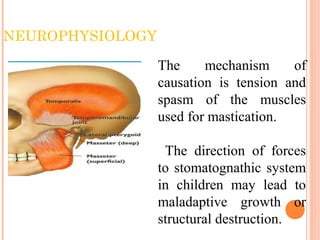 NEUROPHYSIOLOGY
The mechanism of
causation is tension and
spasm of the muscles
used for mastication.
The direction of forces
to stomatognathic system
in children may lead to
maladaptive growth or
structural destruction.
 