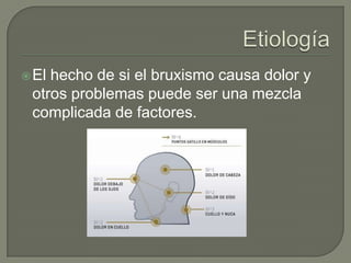 El hecho de si el bruxismo causa dolor y
otros problemas puede ser una mezcla
complicada de factores.
 