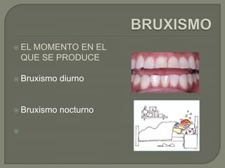  EL MOMENTO EN EL
QUE SE PRODUCE
 Bruxismo diurno
 Bruxismo nocturno

 