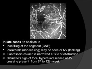 In late cases :in addition to
• nonfilling of the segment (CNP)
• collaterals (non-leaking) may be seen or NV (leaking)
 Fluorescein column is narrowed at site of obstruction.
 Clemette’s sign of focal hyperfluorescence at AV
crossing present from 6th to 12th week.
 