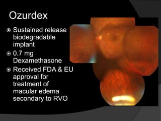 Ozurdex
 Sustained release
biodegradable
implant
 0.7 mg
Dexamethasone
 Received FDA & EU
approval for
treatment of
macular edema
secondary to RVO
 