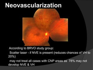 Neovascularization
According to BRVO study group:
Scatter laser - if NVE is present (reduces chances of VH to
20%)
may not treat all cases with CNP areas as 78% may not
develop NVE & VH
 